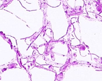 Candida under microscope